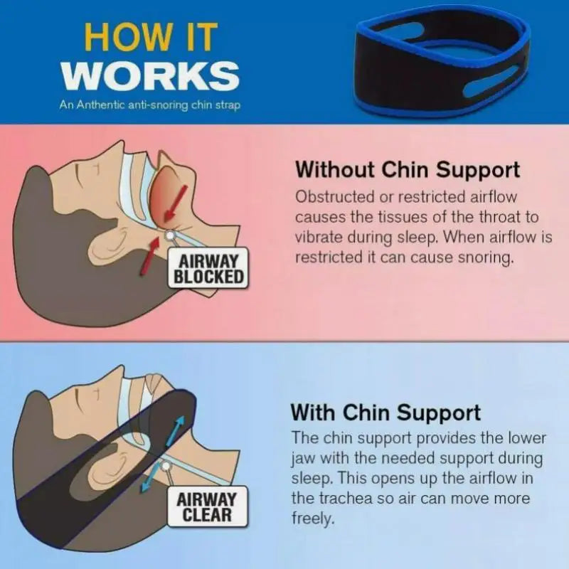 Anti-Snoring Chin Strap Mouth Guard