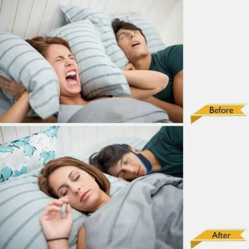 Anti-Snoring Chin Strap Mouth Guard
