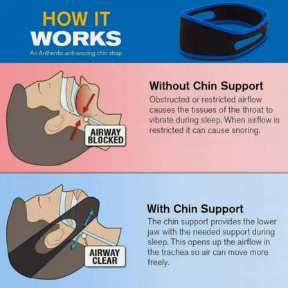 Anti-Snoring Chin Strap Mouth Guard